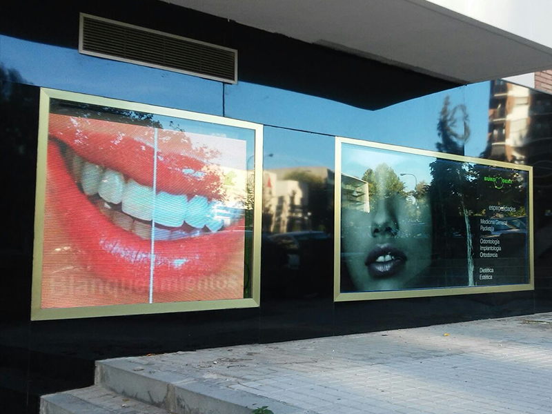 pantalla p6 interior en clinica dental madrid escaparte